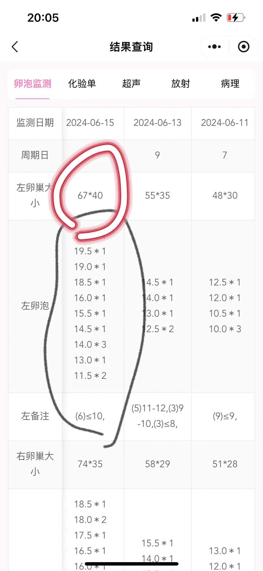 唐山三代供卵试管婴儿比较好的私立医院哪里好，唐山供卵试管医院过程解答