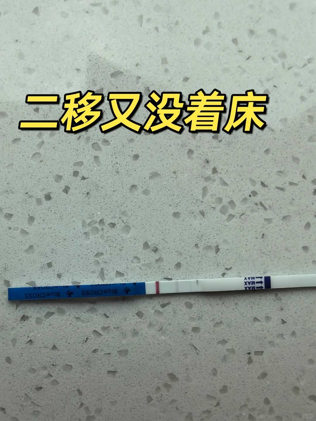 代孕哪里有助孕,卵巢囊肿是什么原因引起的